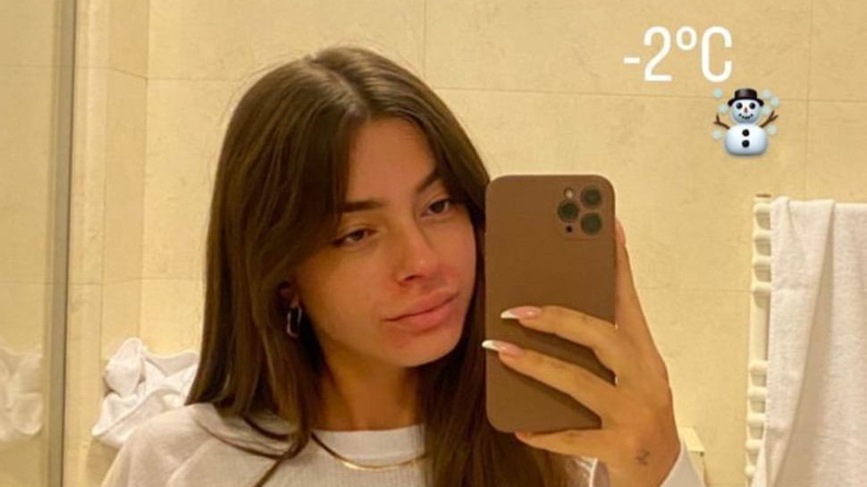 דיאן שוורץ עם פריחה על פניה (צילום: צילום מסך אינסטגרם)