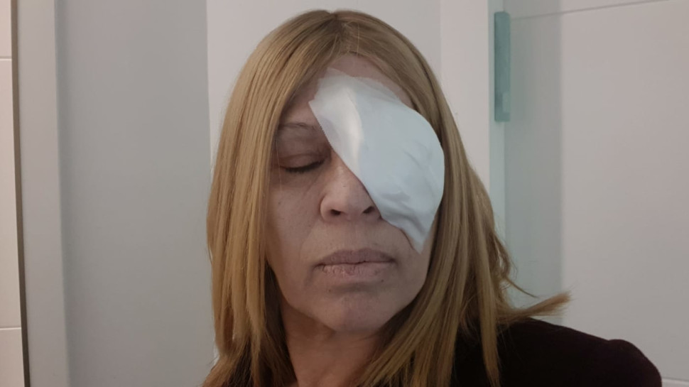 יהודית באומן לאחר הניתוח (צילום: פרטי)