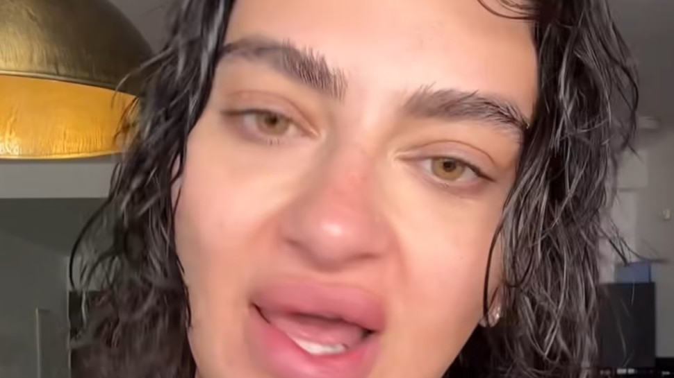 פרידה עוזיאל על הפפילומה  (צילום: יחסי ציבור)