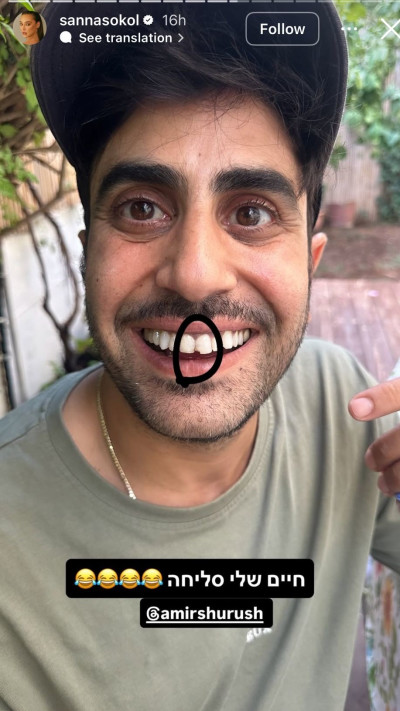 אמיר שורוש נפצע לפני הגמר של רוקדים עם כוכבים (צילום: מתוך אינסטגרם)