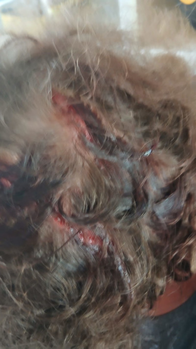 האזרח שהותקף על ידי עובדי המנהל האזרחי