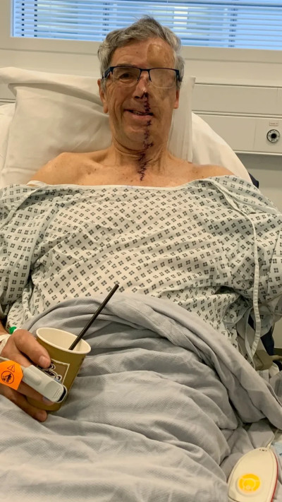 דייב אחרי התאונה