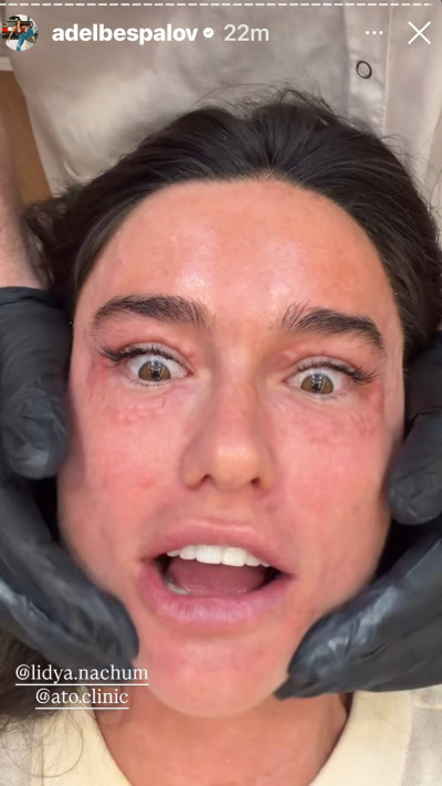 הסטורי של אדל בספלוב (צילום: אינסטגרם)