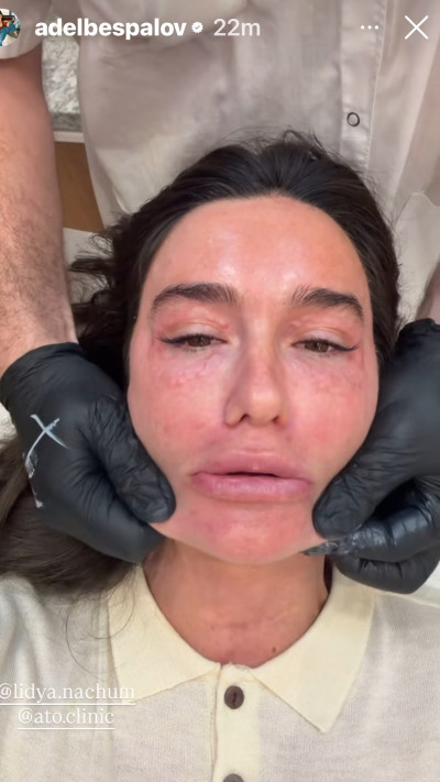 הסטורי של אדל בספלוב (צילום: אינסטגרם)