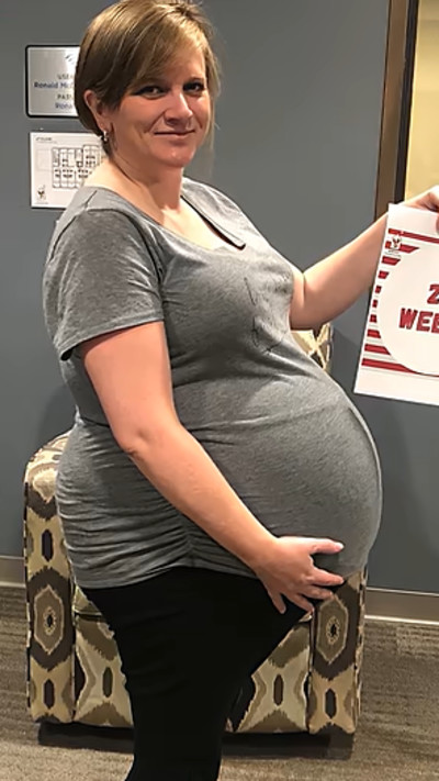 הפתיעה את הרופאים כששרדה עד שבוע 32