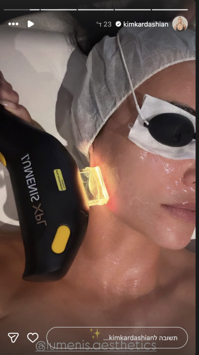 קים קרדשיאן בטיפול פנים אצל קרן ברטוב