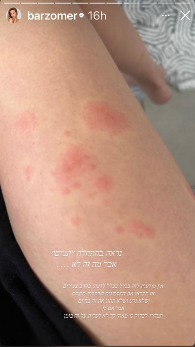 הסטורי של בר זומר (צילום: אינסטגרם)