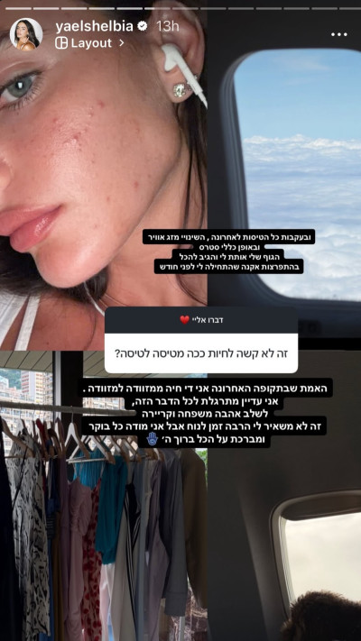 יעל שלביה חושפת אקנה (צילום: אינסטגרם)