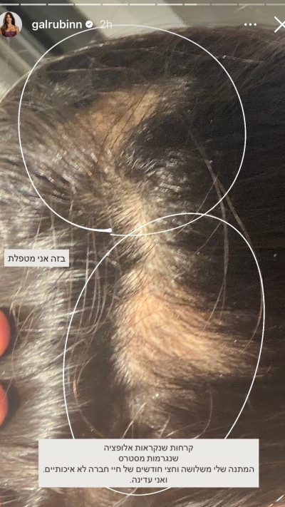 גל רובין (צילום: אינסטגרם)