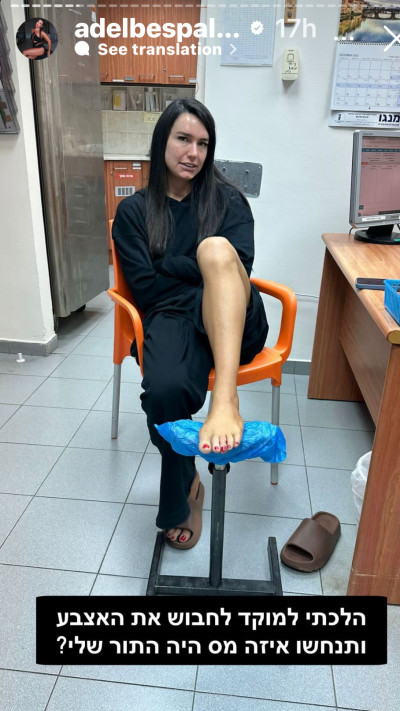 אדל בספלוב משתפת על הפציעה  (צילום: צילום מסך אינסטגרם)