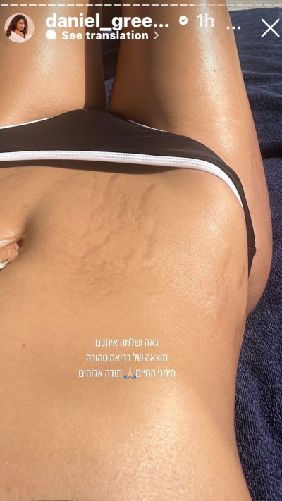 דניאל גרינברג חושפת סימני מתיחה  (צילום: צילום מסך אינסטגרם)