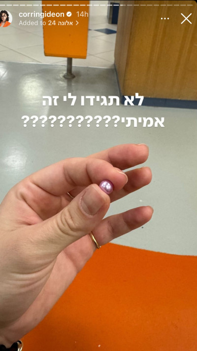 קורין גדעון על החרוז שנכנס לעין של בתה אלונה  (צילום: צילום מסך אינסטגרם)