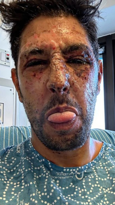 עידן עמדי (צילום: צילום מסך אינסטגרם)