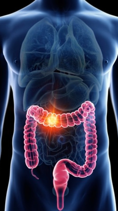  ''הבדיקות הגנומיות-מולקולריות החדשניות מהוות התקדמות משמעותית בטיפול בסרטן המעי הגס''