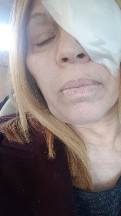 מתאוששת. באומן לאחר הניתוח  (צילום: פרטי)