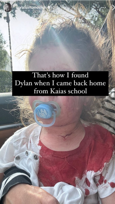 קורל סימנוביץ' על התקרית המלחיצה של בנה דילן (צילום: צילום מסך אינסטגרם)