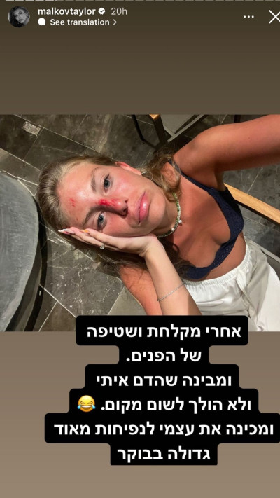 טיילור מלכוב חושפת את הפציעה במהלך החופשה במקסיקו (צילום: צילום מסך אינסטגרם)