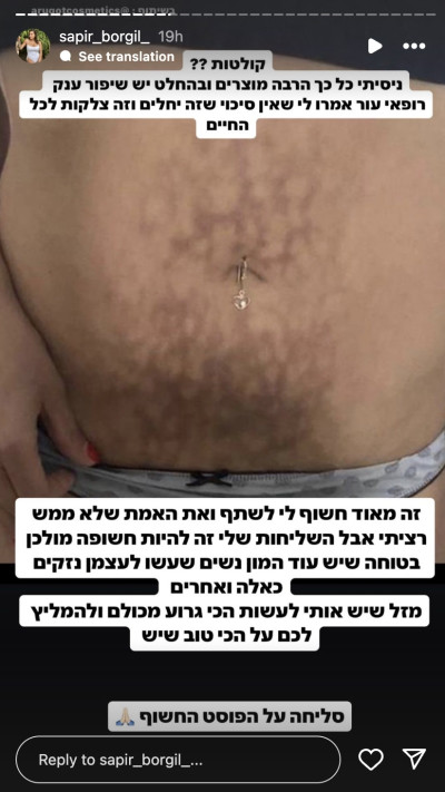 ספיר בורגיל חושפת את הצלקות שלה בבטן (צילום: צילום מסך מתוך האינסטגרם)