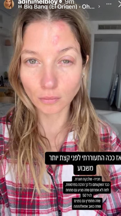 הסטורי של עדי הימלבלוי (צילום: מתוך אינסטגרם)