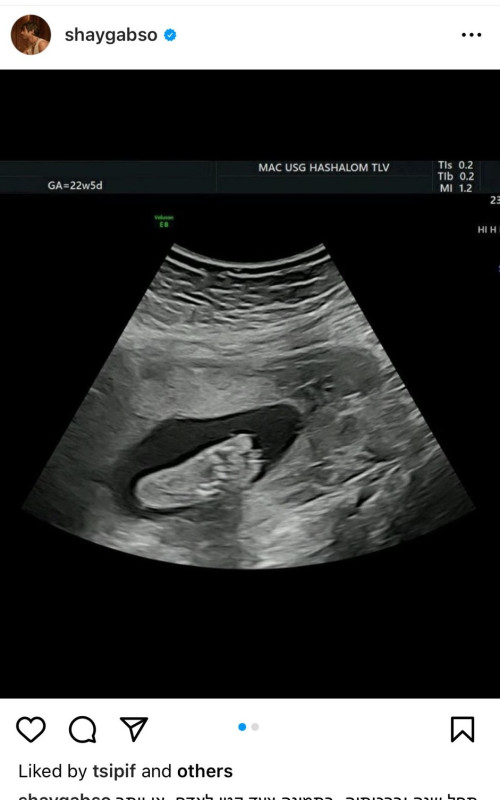 שי גבסו על הולדת בתו הראשונה (צילום: צילום מסך מתוך אינסטגרם)