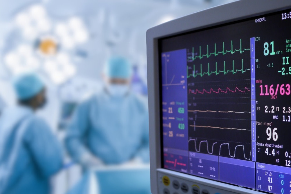 Coffee can protect against atrial fibrillation New research