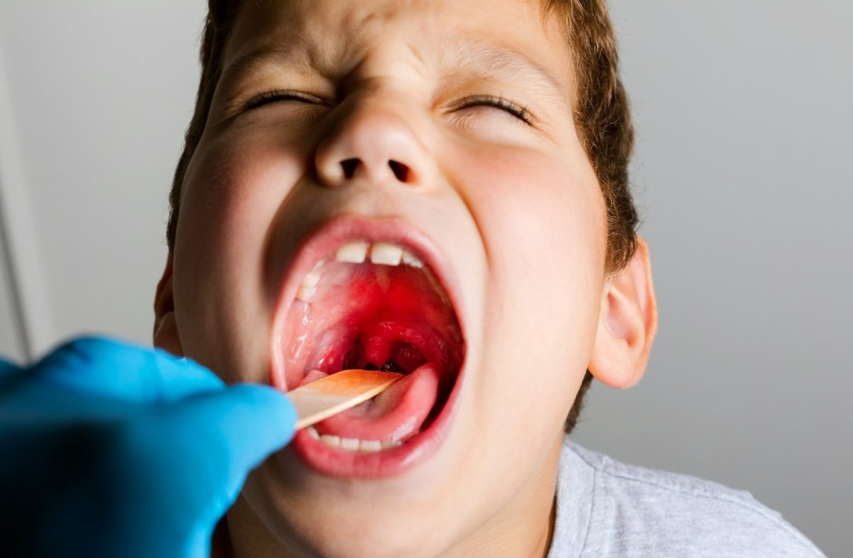 A nationwide outbreak: a sharp increase in Israel in cases of infection with the predatory bacteria