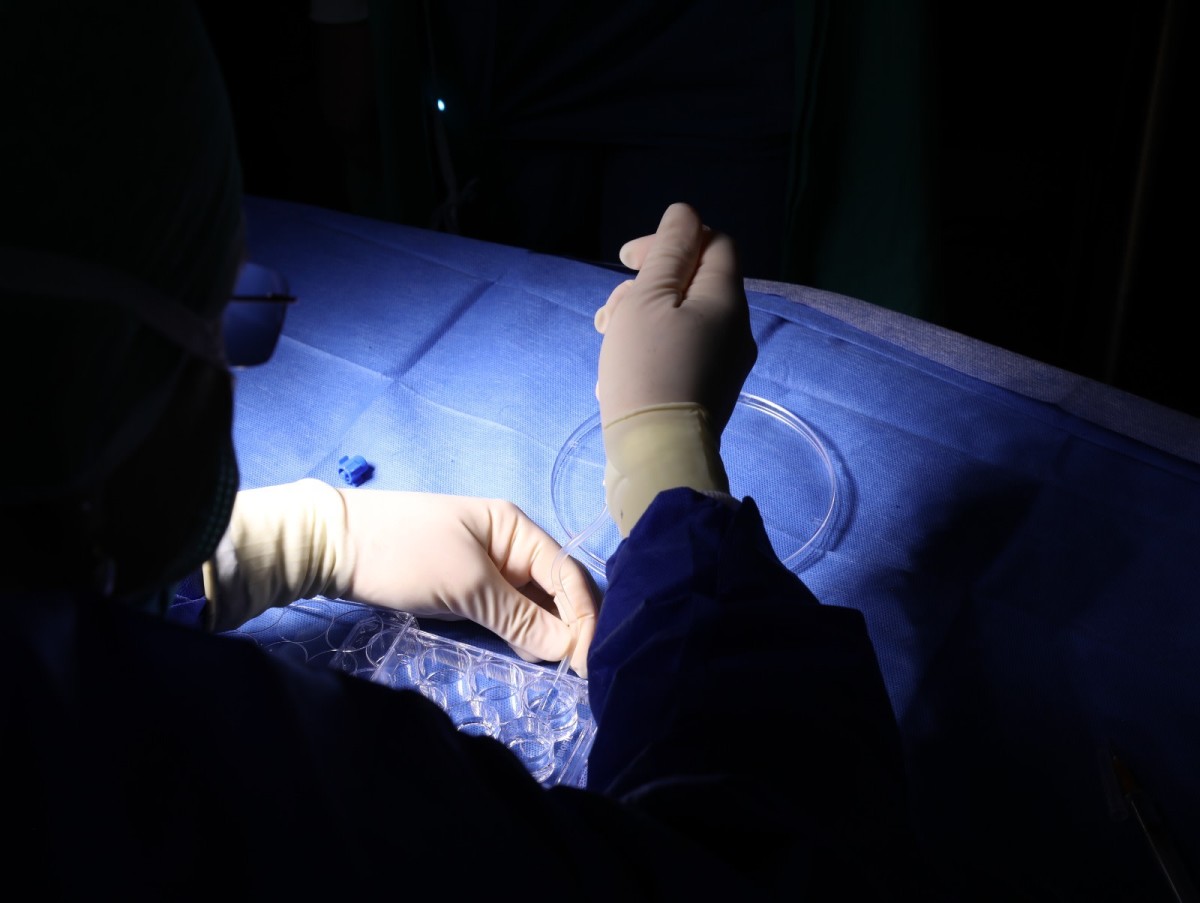 For the first time in the world: a printed biological cornea transplant in a blind woman