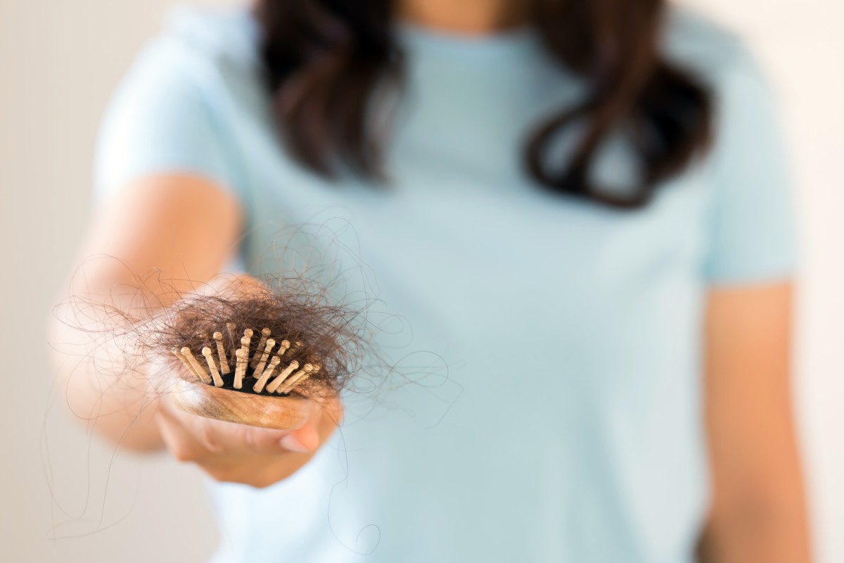 Treating Hair Loss: Insights from Dr. Maya Roseman