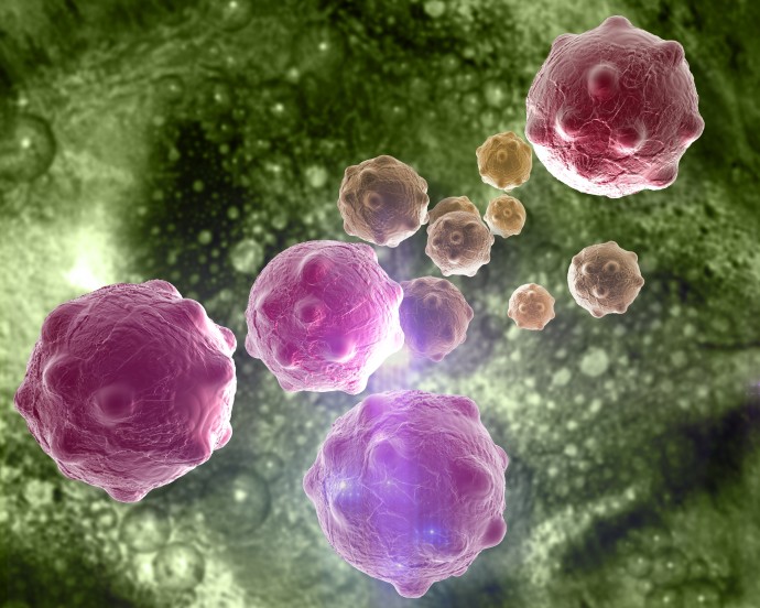 תאים סרטניים (צילום: אינג אימג')