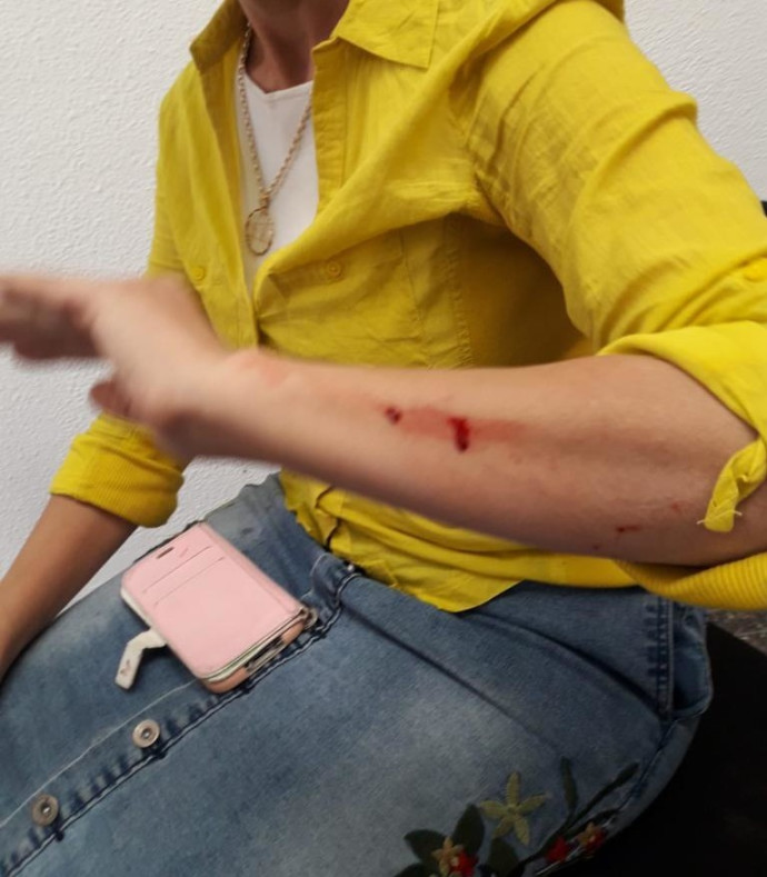 העובדת הסוציאלית שהותקפה בבית דגן (צילום: ללא)