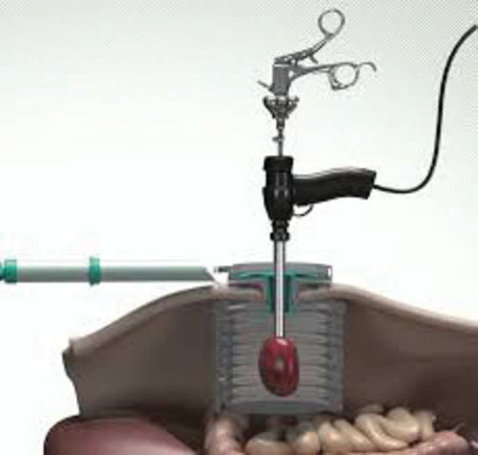 פתרון הLAP BOX