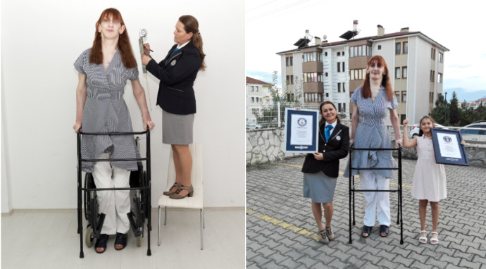 האישה הגבוה ביותר בעולם מגיעה ל-2.15 מטרים (צילום: Guinness World Records)