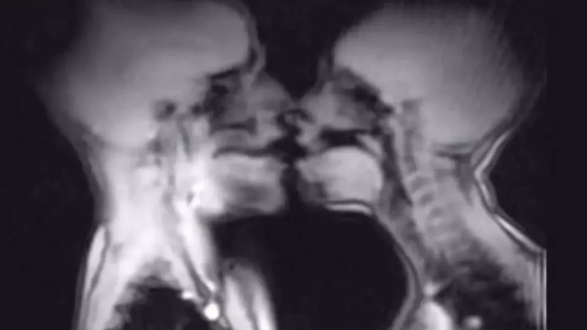 יחסי מין בתוך מכשיר MRI (צילום: צילום מסך)