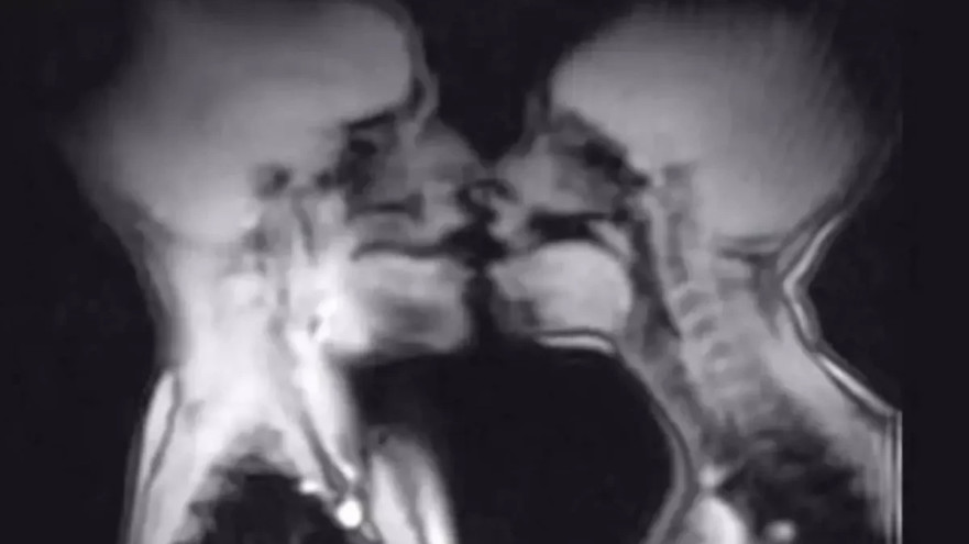 יחסי מין בתוך מכשיר MRI (צילום: צילום מסך)
