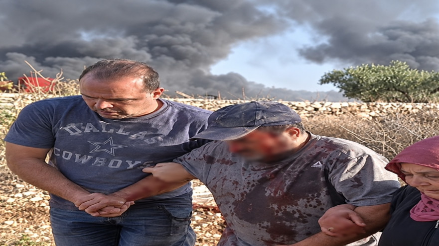 תיעוד מהעימות ביהודה ושומרון (צילום: רשתות חברתיות, שימוש לפי סעיף 27 א')