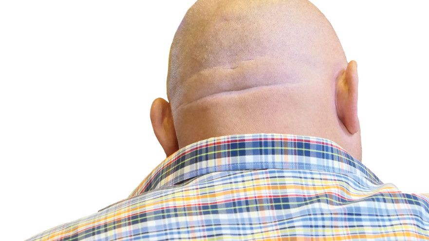 קרחת (צילום: אינג אימג')