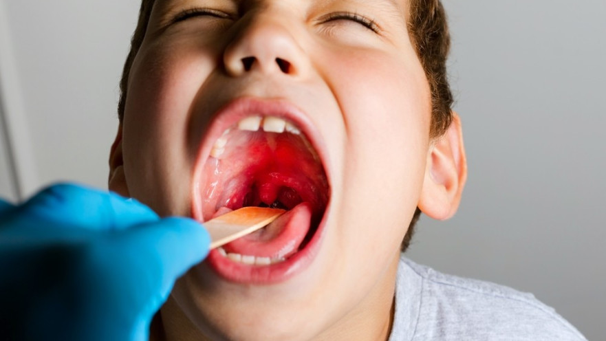 משטח גרון. עליה משמעותית במקרי ההתפשטות