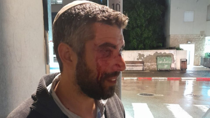 הרב מיפו שהותקף 