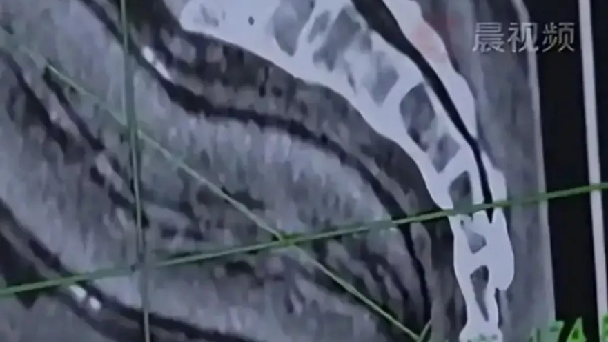 תפוח אדמה בבטנו של הגבר