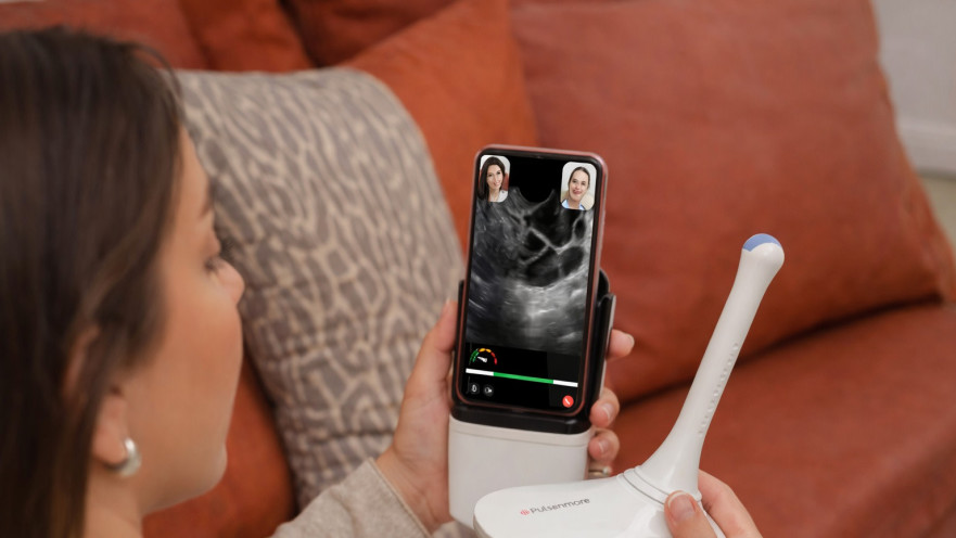 המכשיר החדש. ניטור זקיקים מהבית