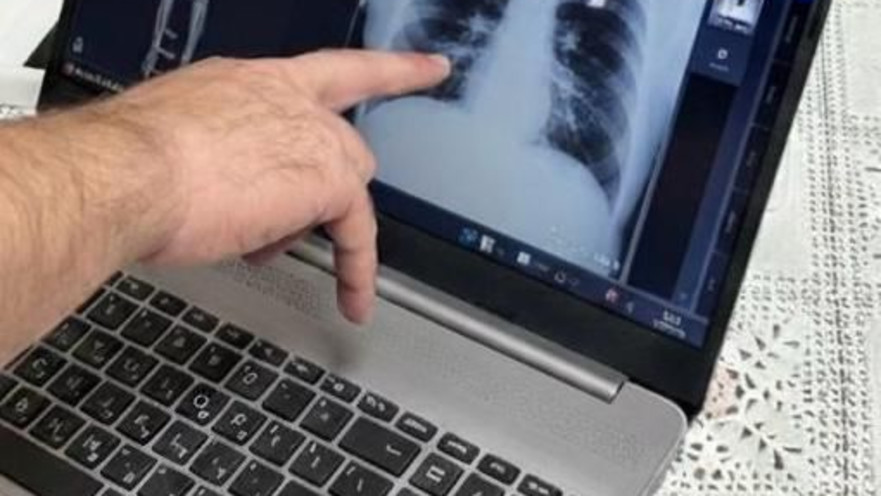 שירות צילומי רנטגן בבית 