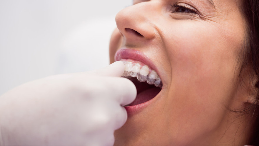 מרפאת שיניים שטיימן חושפת: כך יישור שיניים שקוף שינה את חוקי המשחק