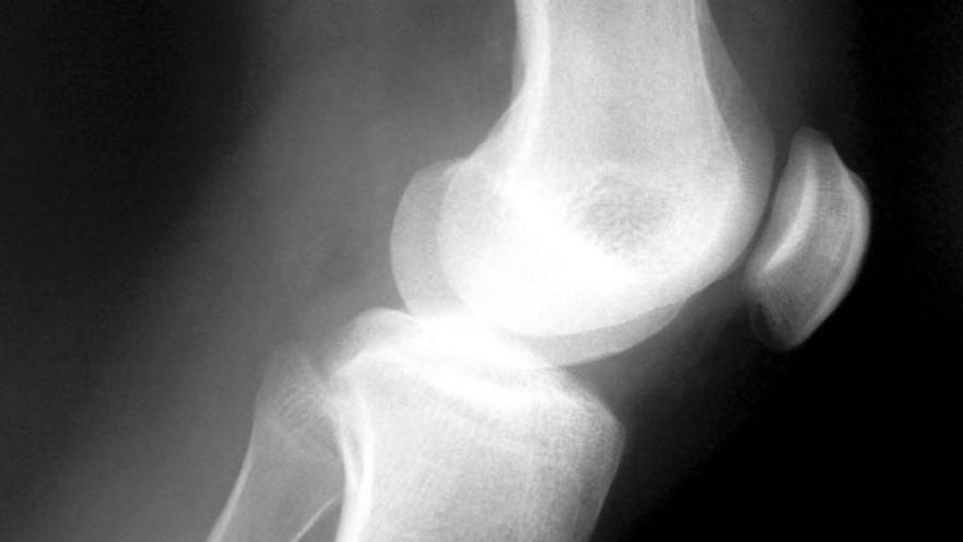 כואב בגדילה