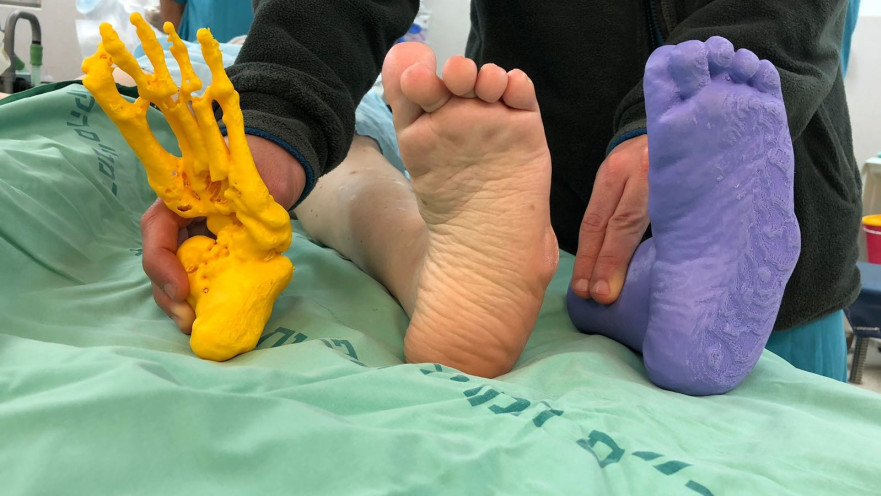 ניתוח בתלת מימד