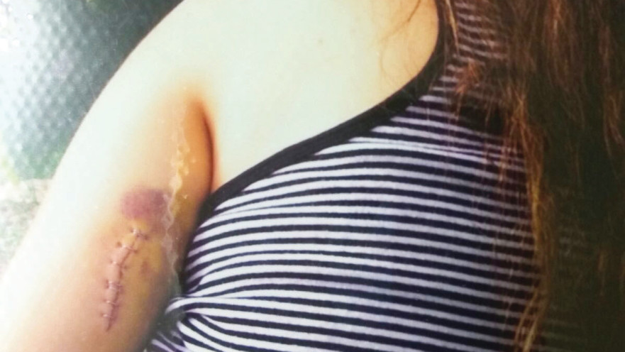 ג' לאחר ניסיון הרצח שלה 