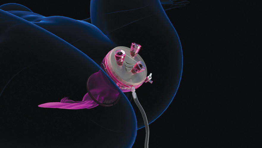 הדמיית הניתוח