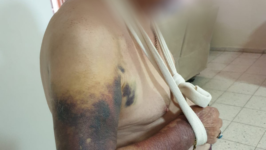 קשיש שהותקף