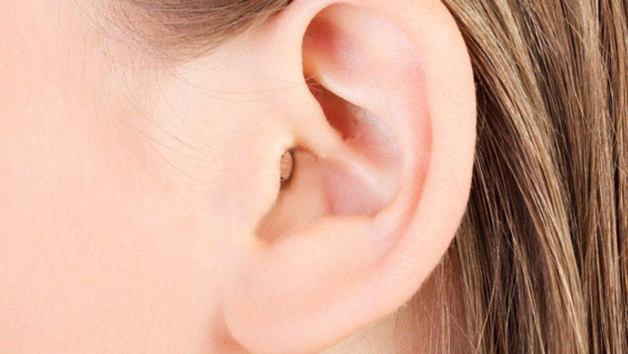 מכשיר שמיעה