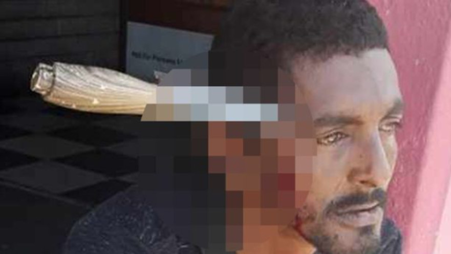 כריסטופר האקר, האזרח שהותקף בראשו