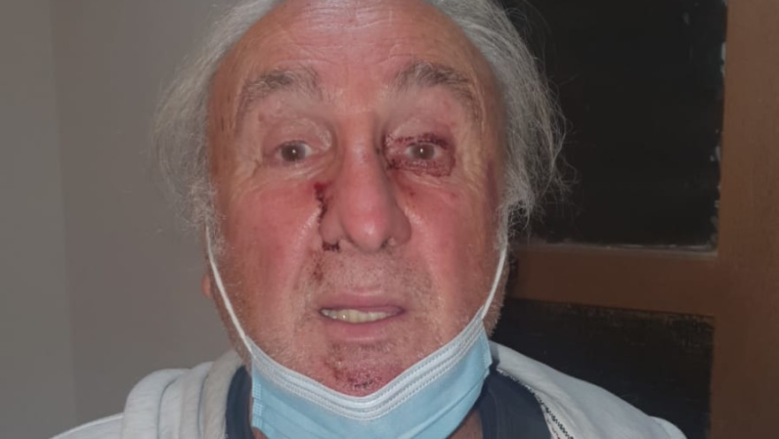 שלמה זייד בן ה-75 שנשדד באלימות במלונו